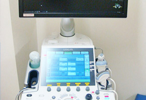 超音波検査装置